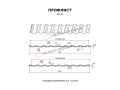 Профлист Металл Профиль МП-20x1100-R NormanMP (ПЭ-01-5002-0,5)